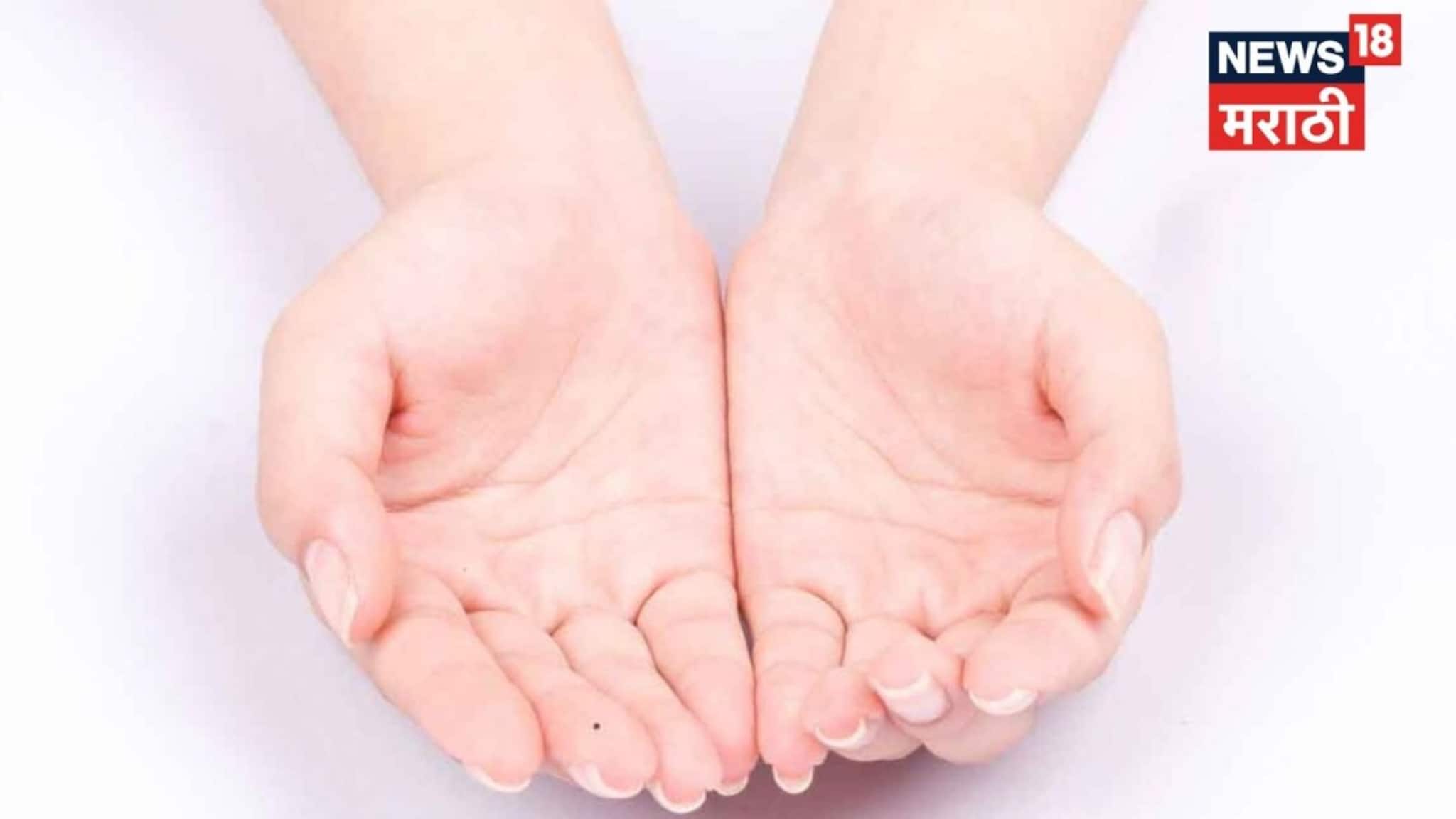 तळहातावर 'या' ठिकाणी तीळ आहे? मग समजा तुमची लॉटरीच लागली; सात पिढ्या बसून खातील एवढी मिळेल संपत्ती!