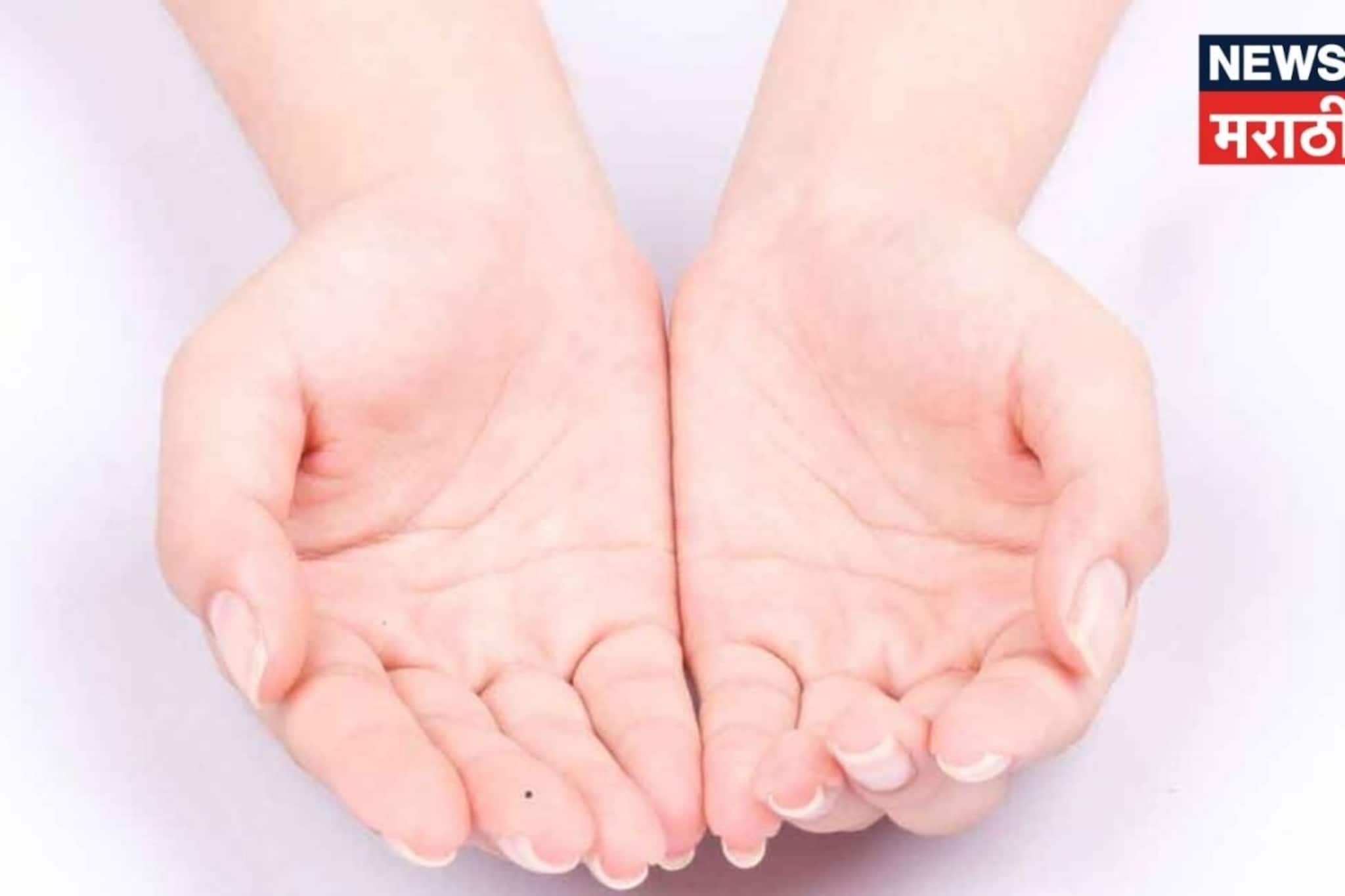 तळहातावर 'या' ठिकाणी तीळ आहे? मग समजा तुमची लॉटरीच लागली