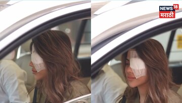 निक्की तांबोळीच्या डोळ्याला काय झालं? अरबाज चिंतेत, दिली हेल्थ अपडेट