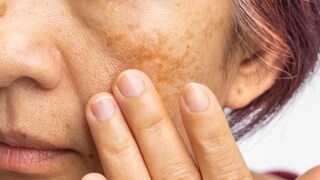 प्रतिकात्मक फोटो