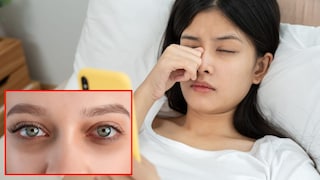 डोळ्यांना सूज येण्याची कारणे डोळ्यांना सूज येण्याची कारणे