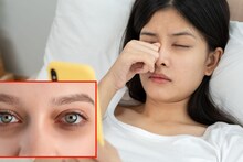 Puffy Eyes : रोज झोपेतून उठल्यानंतर डोळे सूजलेले दिसतात? पाहा कारण आणि 'या' 5 उपायांनी मिळवा आराम