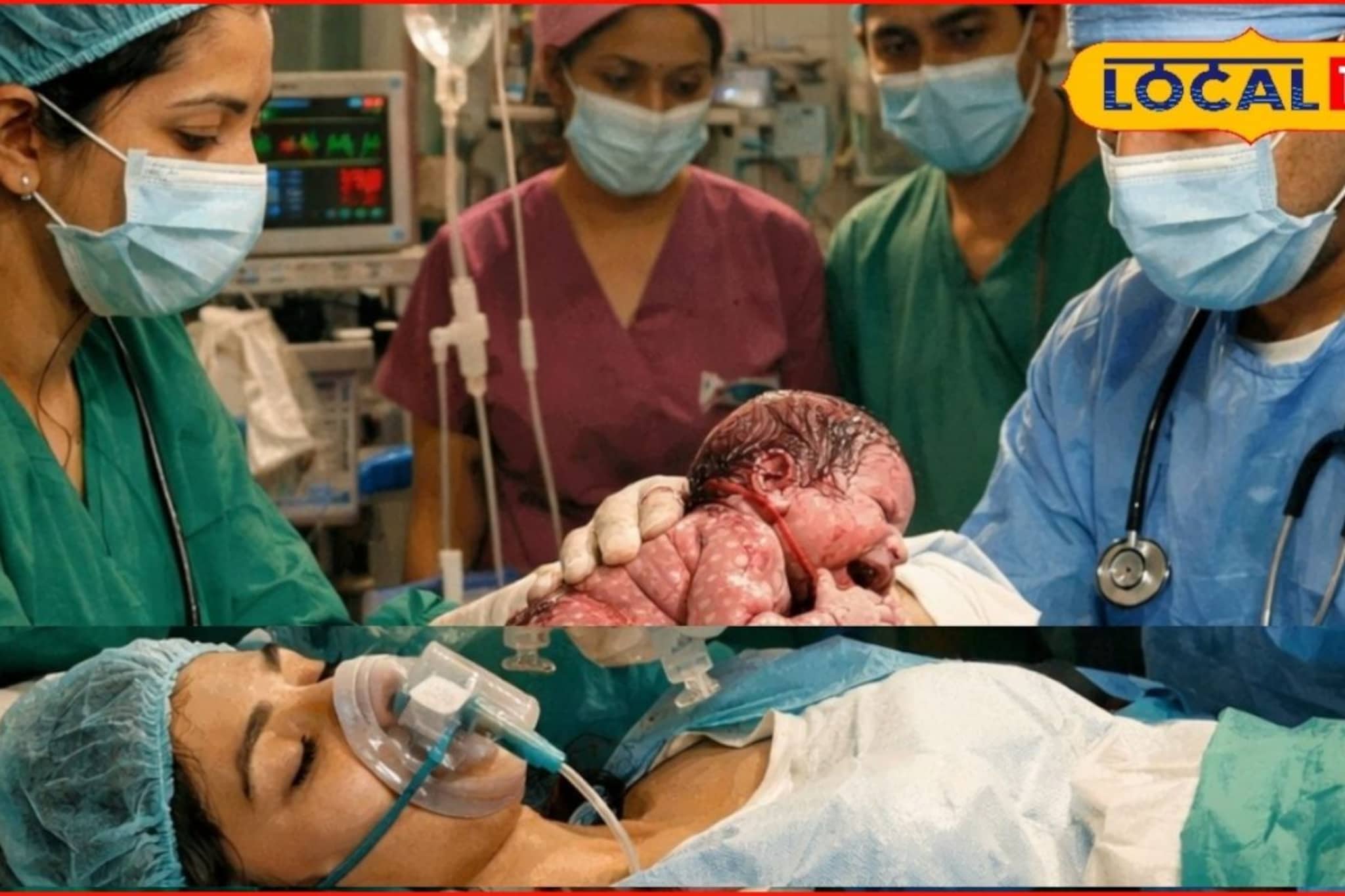 दीड लिटर रक्तस्राव, गर्भवतीची मृत्यूशी झुंज, डॉक्टरांनी निर्णय घेतला, 30 मिनिटां