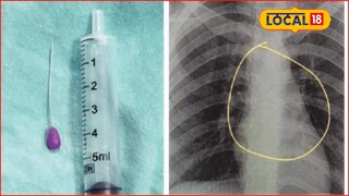 कपडे घालताना तोंडात पिन धरली अन् ठसका आला, काही कळायच्या आत..., छ. संभाजीनगरच्या तरुणीसोबत भयंकर घडलं?
