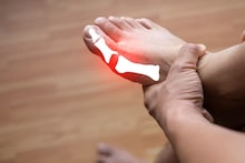 Uric Acid : किडनी खराब होण्यामागे युरिक अॅसिड कारणीभूत? शंका असल्यास 5 महत्त्वाच्या तपासण्या करा