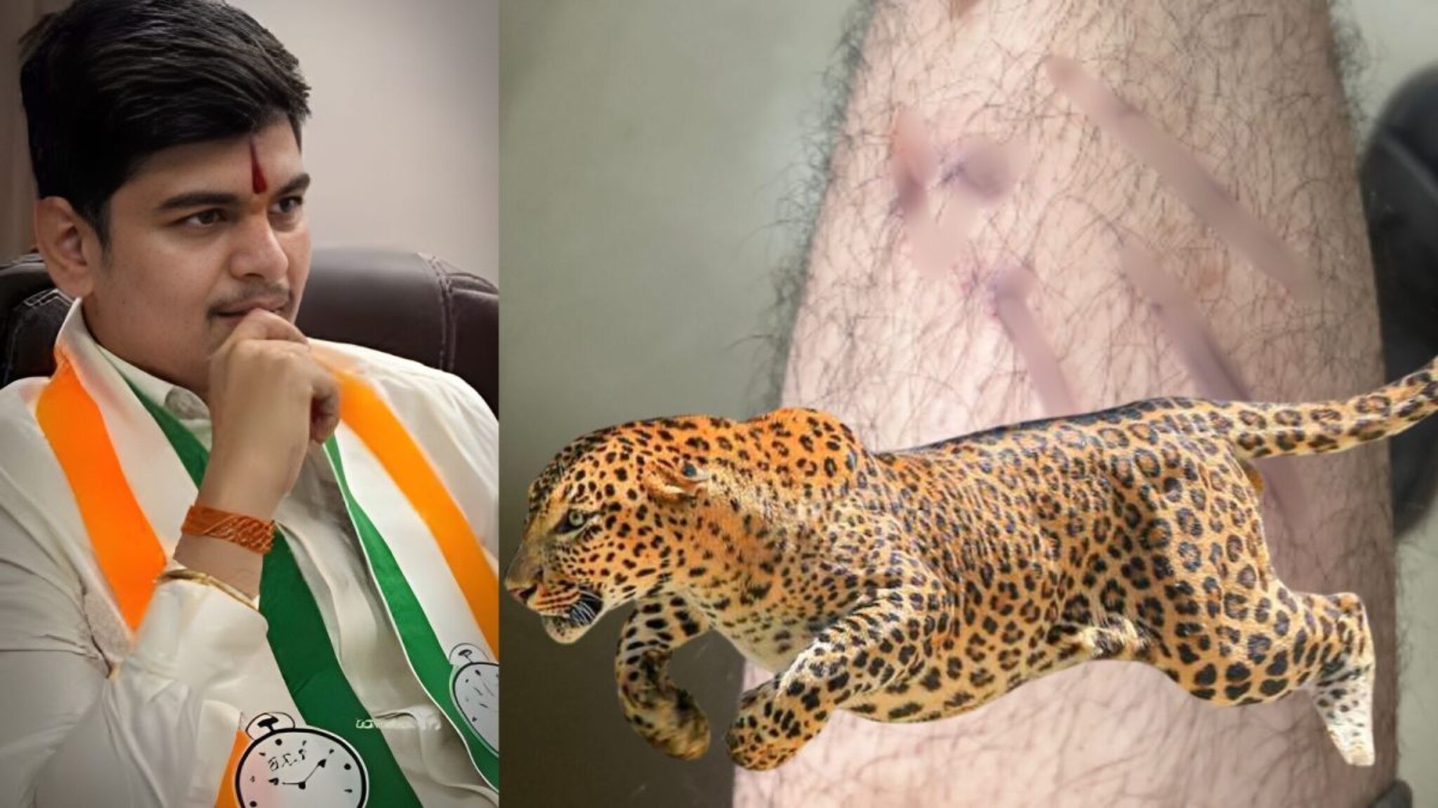 काँग्रेस नेत्याच्या नातवावर बिबट्याचा हल्ला, वडिलांच्या प्रचारावरून घरी येत असतानाच धक्कादायक घटना