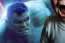 अरे बापरे! अवघ्या दीड वर्षांच्या मुलाने 'हल्क'ला गिळलं; रिपोर्ट पाहून डॉक्टरही धक्क्यात