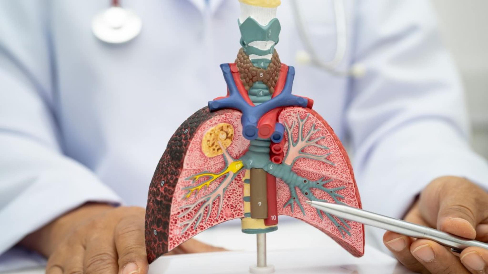 Lungs Cancer : खोकला जास्त काळ टिकला तर दुर्लक्ष नको, असू शकतं फुफ्फुसाच्या कर्करोगाचं लक्षण