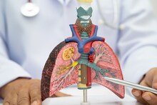 Lungs Cancer : खोकला जास्त काळ टिकला तर दुर्लक्ष नको, असू शकतं फुफ्फुसाच्या कर्करोगाचं लक्षण
