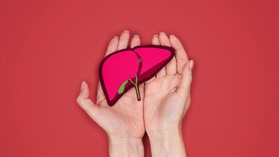 भारत में तेजी से बढ़ रहा है फैटी लिवर का खतरा: कारण और बचाव के उपाय.