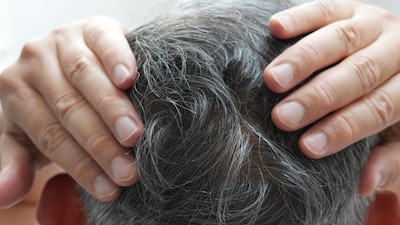 Gray Hair Solutions: Ayurvedic Oils & Home Remedies for Natural Hair Darkening
