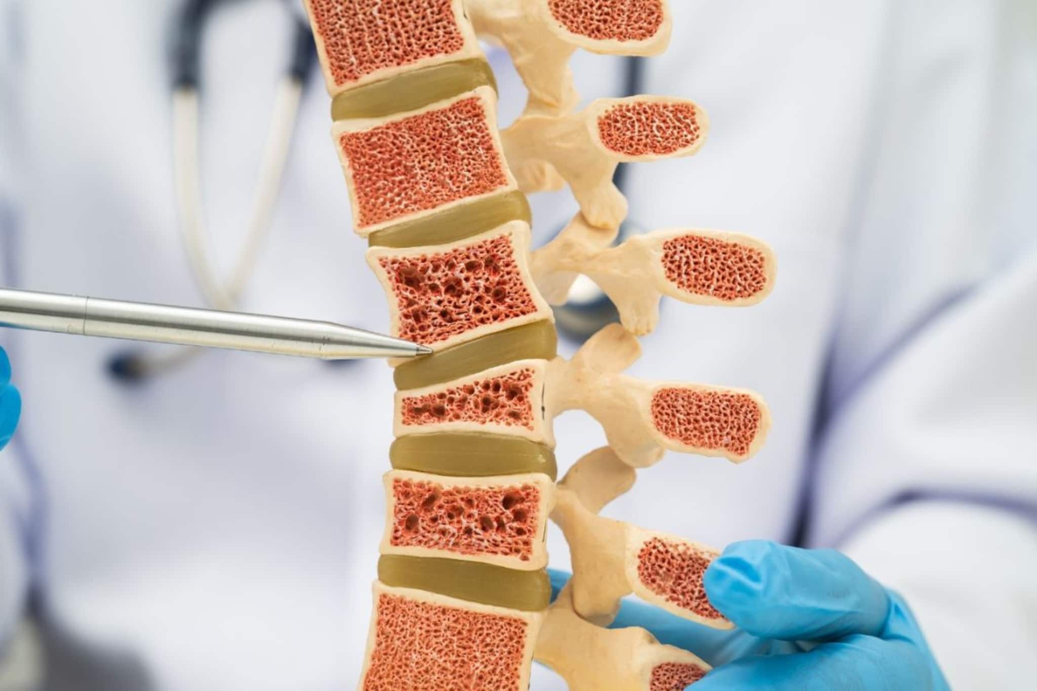 Bone Density : उठ बस करताना हाडांमधे वेदना होतात ? जाणून घ्या कारणं, उपचार Bone Density : उठ बस करताना हाडांमधे वेदना होतात ? जाणून घ्या कारणं, उपचार