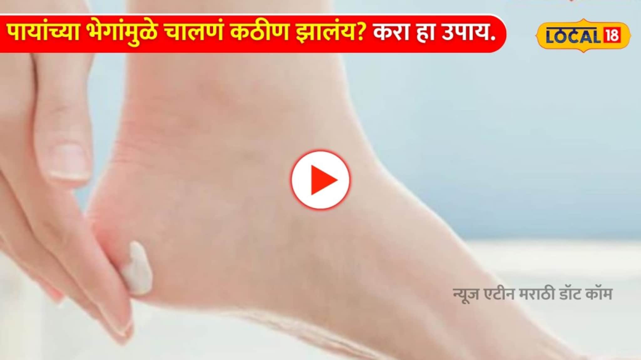 पायांच्या भेगांमुळे चालणं कठीण झालंय? करा 'हा' एक उपाय झटक्यात पडेल फरक !