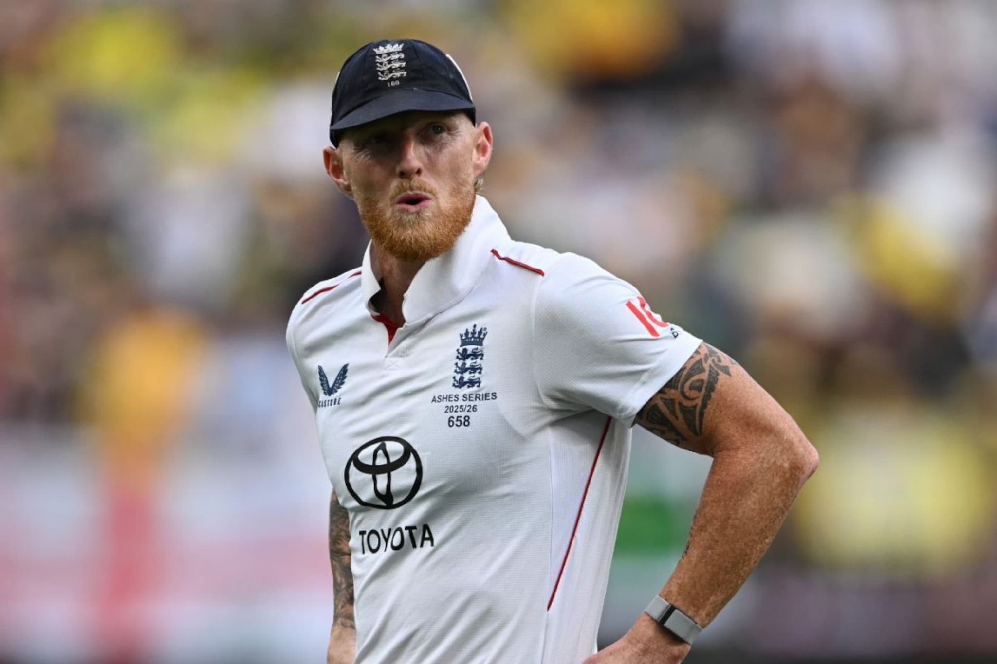 डोळा सुजला, चेहरा हिरवा-निळा, बेन स्टोक्सची अवस्था धक्कादायक, शॉकिंग Photo