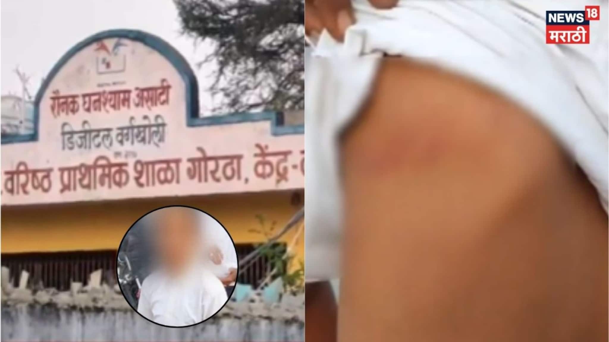 Video: शिक्षिकेकडून विद्यार्थ्याला बेदम मारहाण, विद्यार्थी बेशुद्ध, पाठीवर व्रण उठले