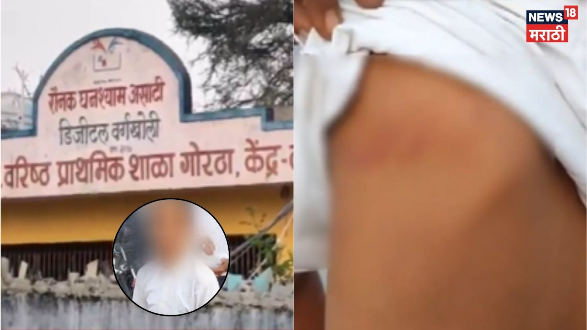 Video: शिक्षिकेकडून विद्यार्थ्याला बेदम मारहाण, विद्यार्थी बेशुद्ध, पाठीवर व्रण उठले