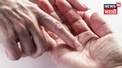 हथेली पर 'H' चिन्ह: 30-35 के बाद खुलता है भाग्य, जानें इसका रहस्य!