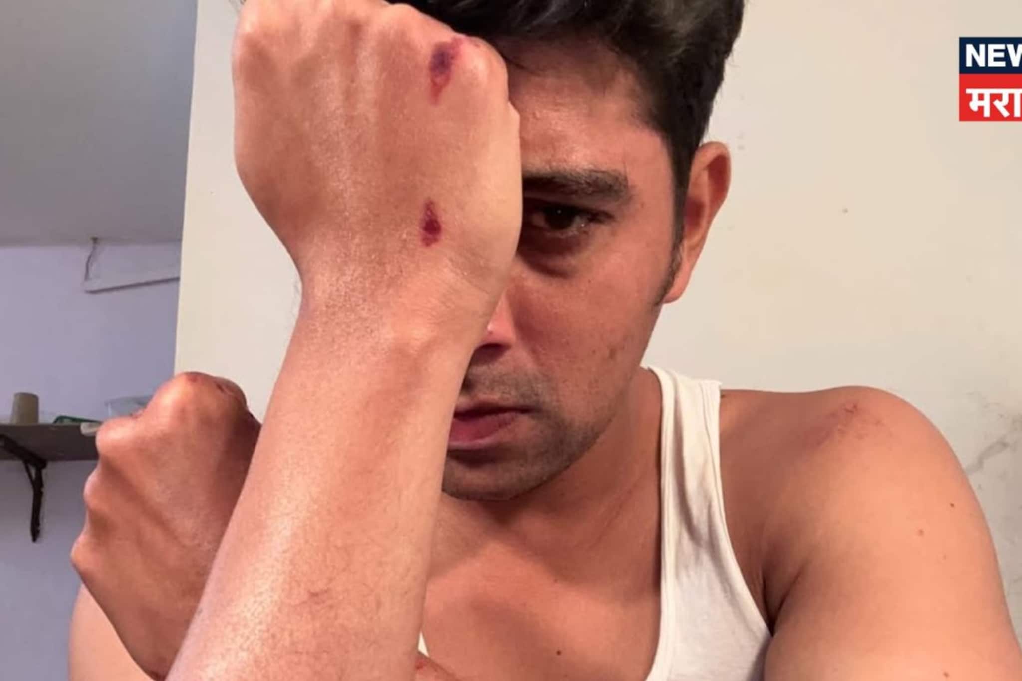 'सावळ्याची जणू सावली' फेम अभिनेत्याचा भीषण अपघात, मरणाच्या दारातून परत आला