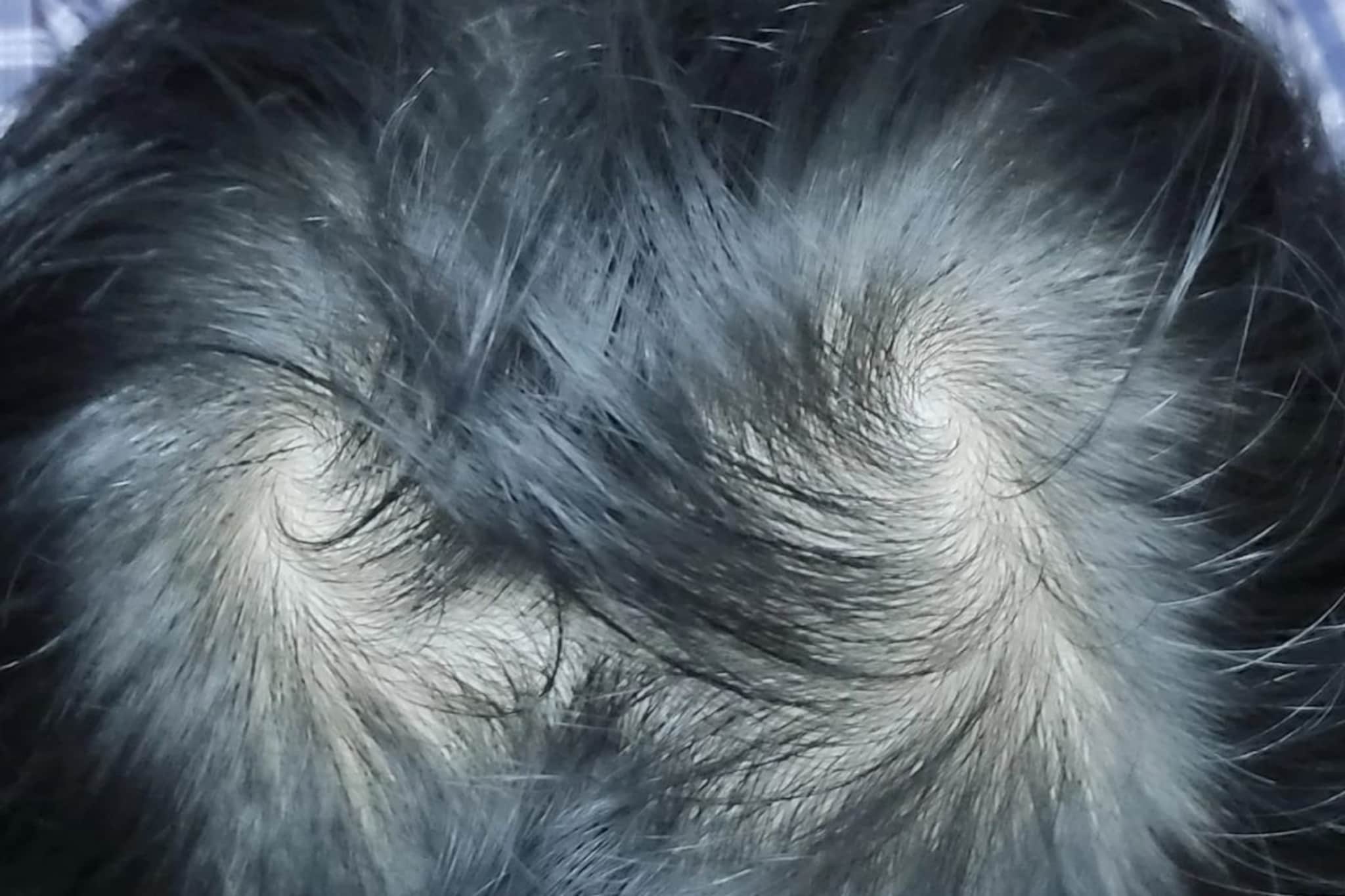 डोक्यावर दोन भोवरे असणाऱ्यांचे दोन लग्न होतात? ही अफवा की वास्तव? वाचा सविस्तर