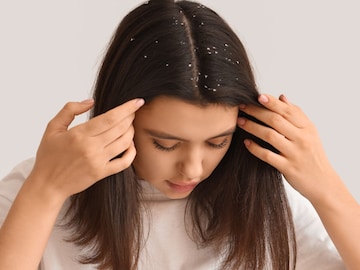 स्वच्छ केलं तरी केसांतील कोंडा वारंवार येतो? कडुलिंबाचे 'हे' उपाय सोडवतील समस्या स्वच्छ केलं तरी केसांतील कोंडा वारंवार येतो? कडुलिंबाचे 'हे' उपाय सोडवतील समस्या