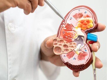 Kidney Cancer : किडनीच्या कॅन्सरपूर्वी शरीरात दिसतात ही लक्षणं, अजिबात करु नका Ignore, उशीर झाला तर पश्चातापाची येईल वेळ 