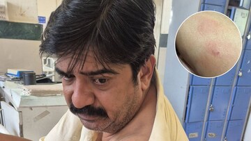 माझ्या मांडीचा चावा घेतला! पुण्यातील टेकडीवर 'पिट्या भाई'सोबत घडला भयंकर प्रकार माझ्या मांडीचा चावा घेतला! पुण्यातील टेकडीवर 'पिट्या भाई'सोबत घडला भयंकर प्रकार