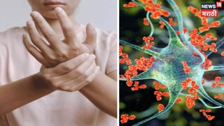 Pune GBS Case Outbreak In purandar