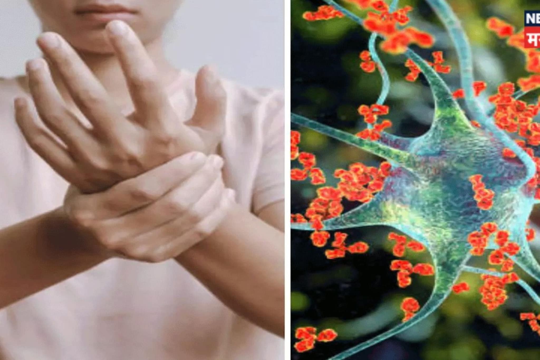 Pune : पुन्हा GBS ची एन्ट्री! या भागात दहशत, 51 वर्षाच्या व्यक्तीचा मृत्यू