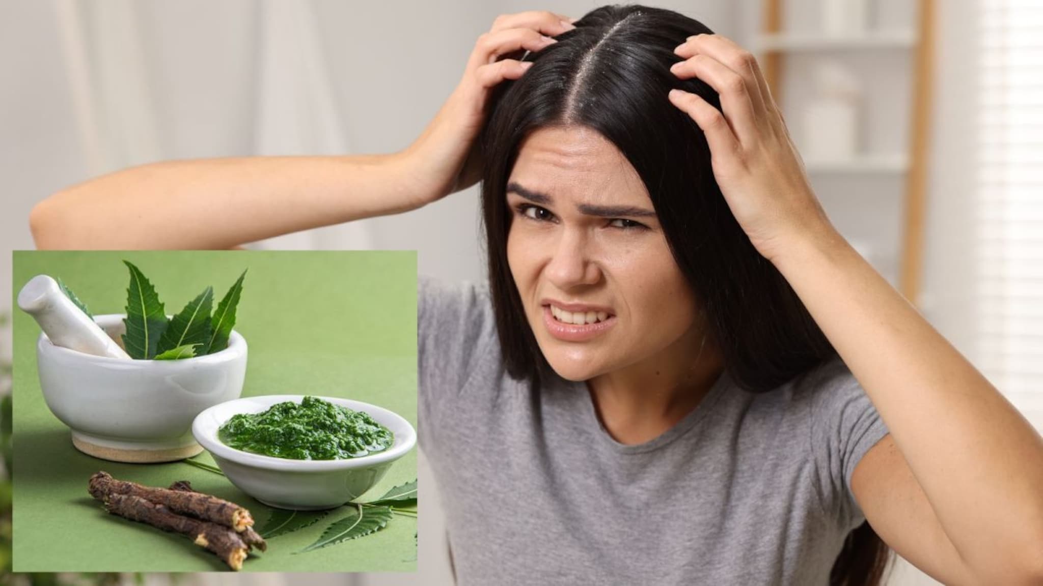 Dandruff Remedy : कितीही स्वच्छ केलं तरी केसांतील कोंडा वारंवार येतो? कडुलिंबाचे 'हे' उपाय सोडवतील समस्या..