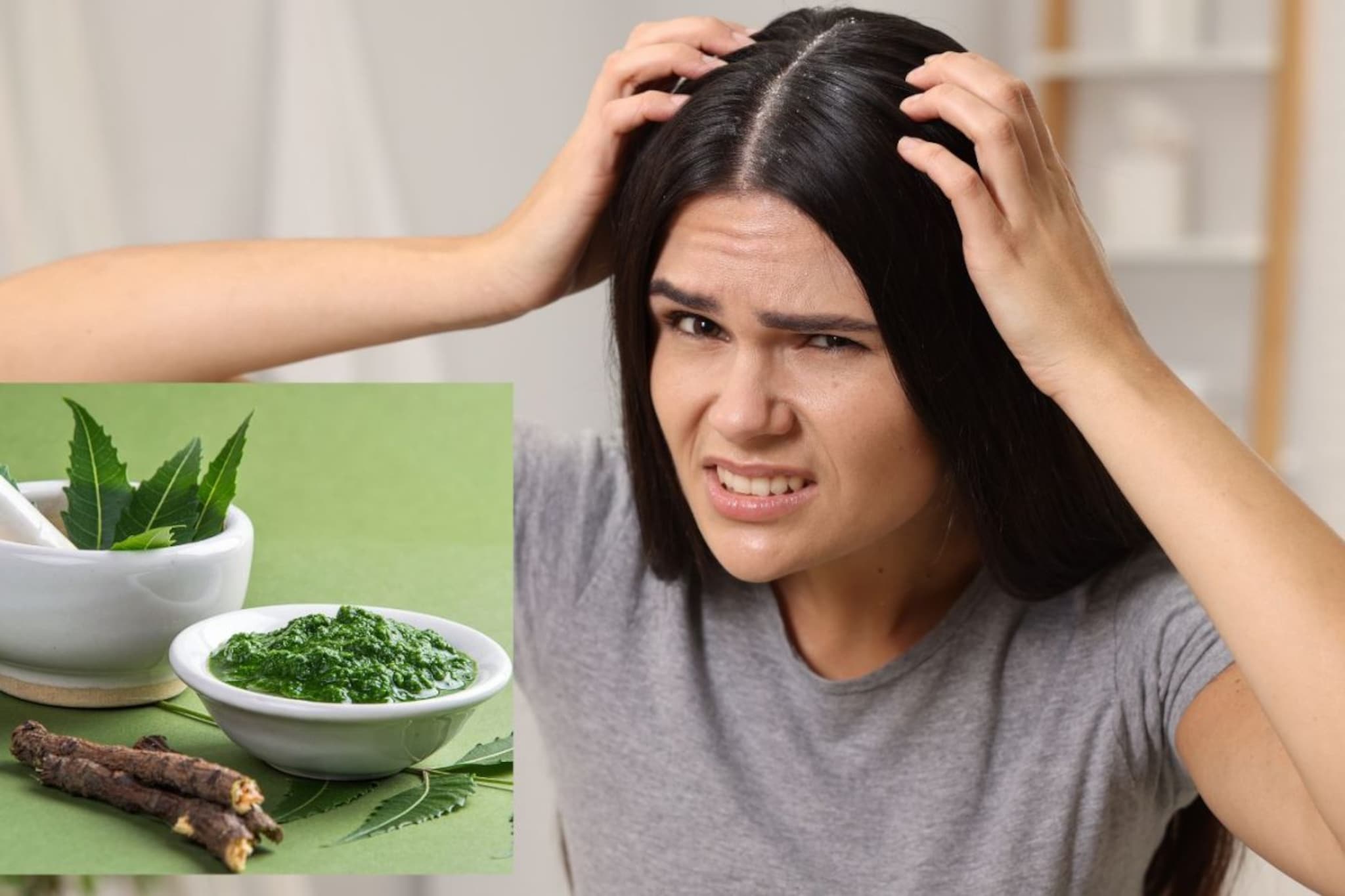 स्वच्छ केलं तरी केसांतील कोंडा वारंवार येतो? कडुलिंबाचे 'हे' उपाय सोडवतील समस्या स्वच्छ केलं तरी केसांतील कोंडा वारंवार येतो? कडुलिंबाचे 'हे' उपाय सोडवतील समस्या