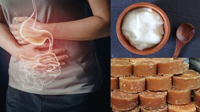 Digestion Woes? Yogurt-Jaggery Cleans Intestines, Boosts Immunity