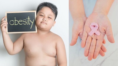 Childhood Obesity: Major Cancer Risk in Adulthood, Be Alert in Time!