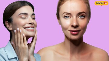 उन्हाळ्याची तयारी आतापासूनच, 'या' उपायाने टॅनिंग आणि सनबर्नचं टेन्शन होईल दूर