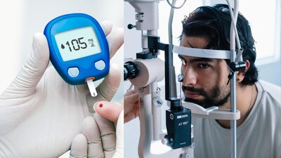 Diabetes & Eyes: High Blood Sugar Causes Severe Damage, Risking Vision Loss