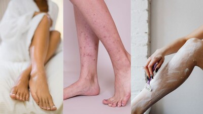 हे डाग त्वचेवर स्ट्रॉबेरीच्या बियांसारखे दिसतात. यामुळे आपला संपूर्ण लुक खराब होतो. वॅक्सिंग मुळातच आपण पाय सुंदर दिसावे यासाठी करतो. मात्र त्यानंतर पायांवर जर अशाप्रकारचे चिन्ह दिसत असतील तर ते खूप वाईट असतं. मात्र हे कशामुळे होतं आणि त्यापासून वाचण्याचे काही उपायही आहेत.   