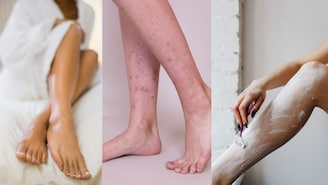 शेव्हिंग-व्हॅक्सिंग केल्यानंतर पायांवर काळे डाग पडतात? 'या' चुकीमुळे होतो 'स्ट्रॉबेरी लेग्ज'चा त्रास