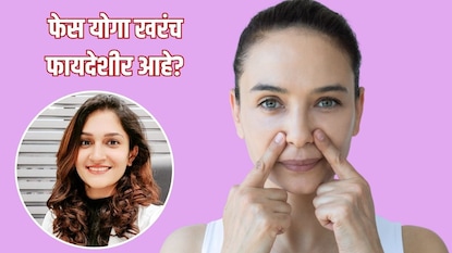 डर्माटोजिस्टचं मत काय.. डर्माटोजिस्टचं मत काय..