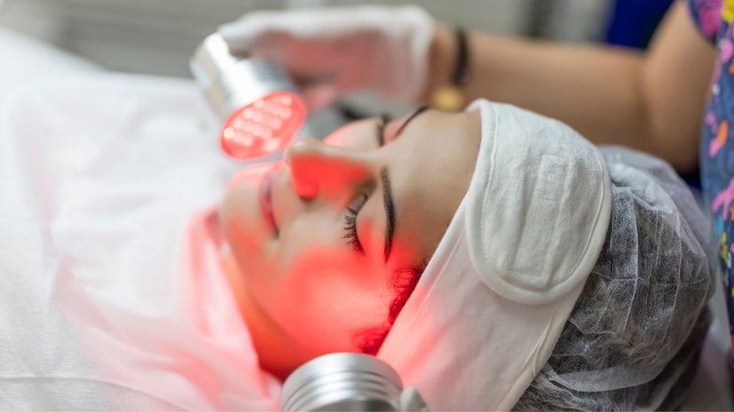 चेहऱ्यावरील सुरकुत्या, पिंपल्स, डाग आणि सूर्यप्रकाशामुळे होणारे नुकसान अशा त्वचेच्या विविध समस्यांवर उपचार म्हणून रेड लाईट थेरपी हल्ली खूप वापरली जात आहे. पण तुम्हाला माहितीये का ही रेड लाईट थेरपी कशी काम करते आणि तिचे आणखी काय फायदे आहेत? चला पाहूया. चेहऱ्यावरील सुरकुत्या, पिंपल्स, डाग आणि सूर्यप्रकाशामुळे होणारे नुकसान अशा त्वचेच्या विविध समस्यांवर उपचार म्हणून रेड लाईट थेरपी हल्ली खूप वापरली जात आहे. पण तुम्हाला माहितीये का ही रेड लाईट थेरपी कशी काम करते आणि तिचे आणखी काय फायदे आहेत? चला पाहूया.