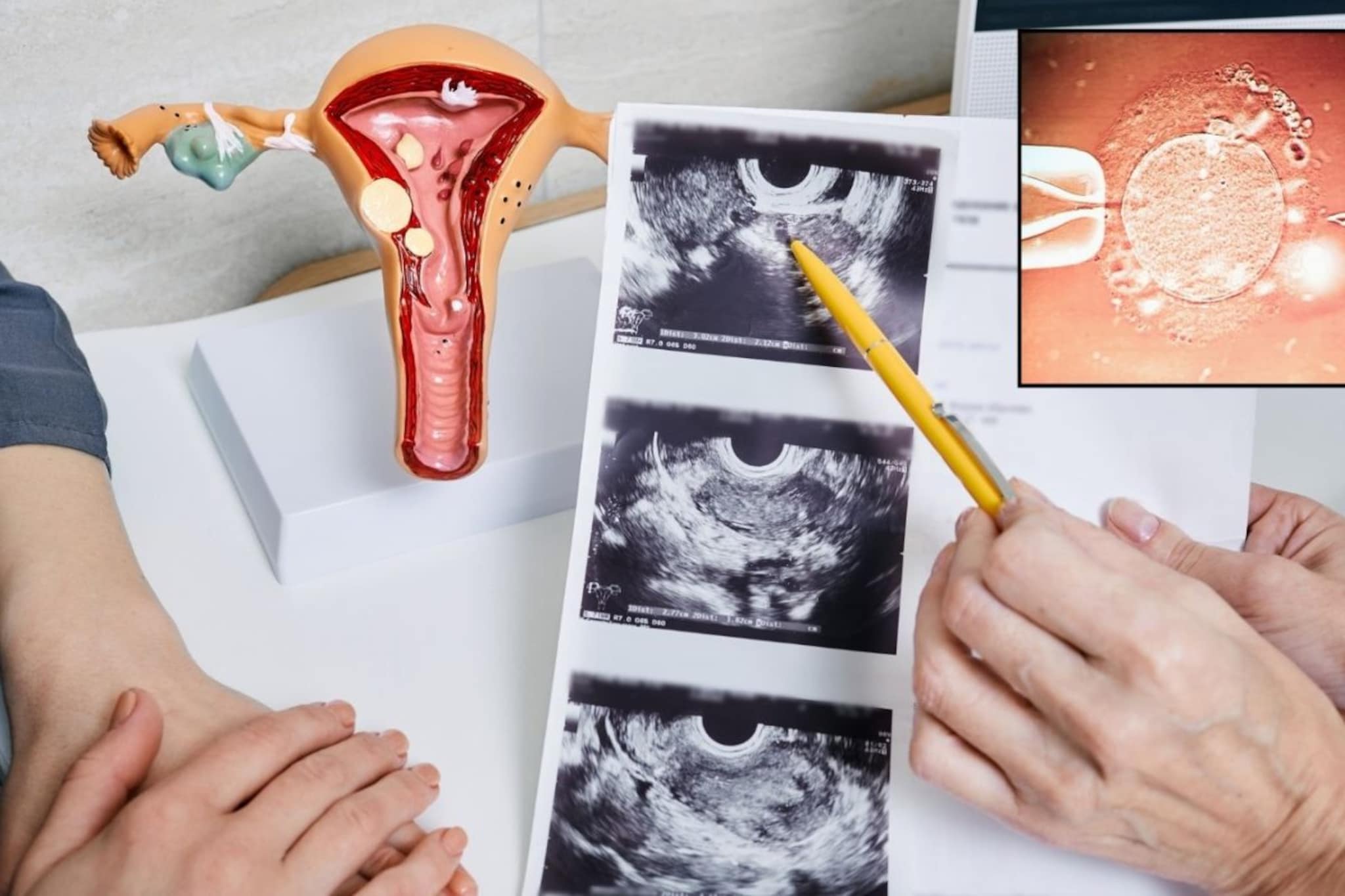 स्त्रीबीजांची विक्री! म्हणजे नेमकं करतात काय, महिलांच्या शरीरातून बीज कसे काढतात