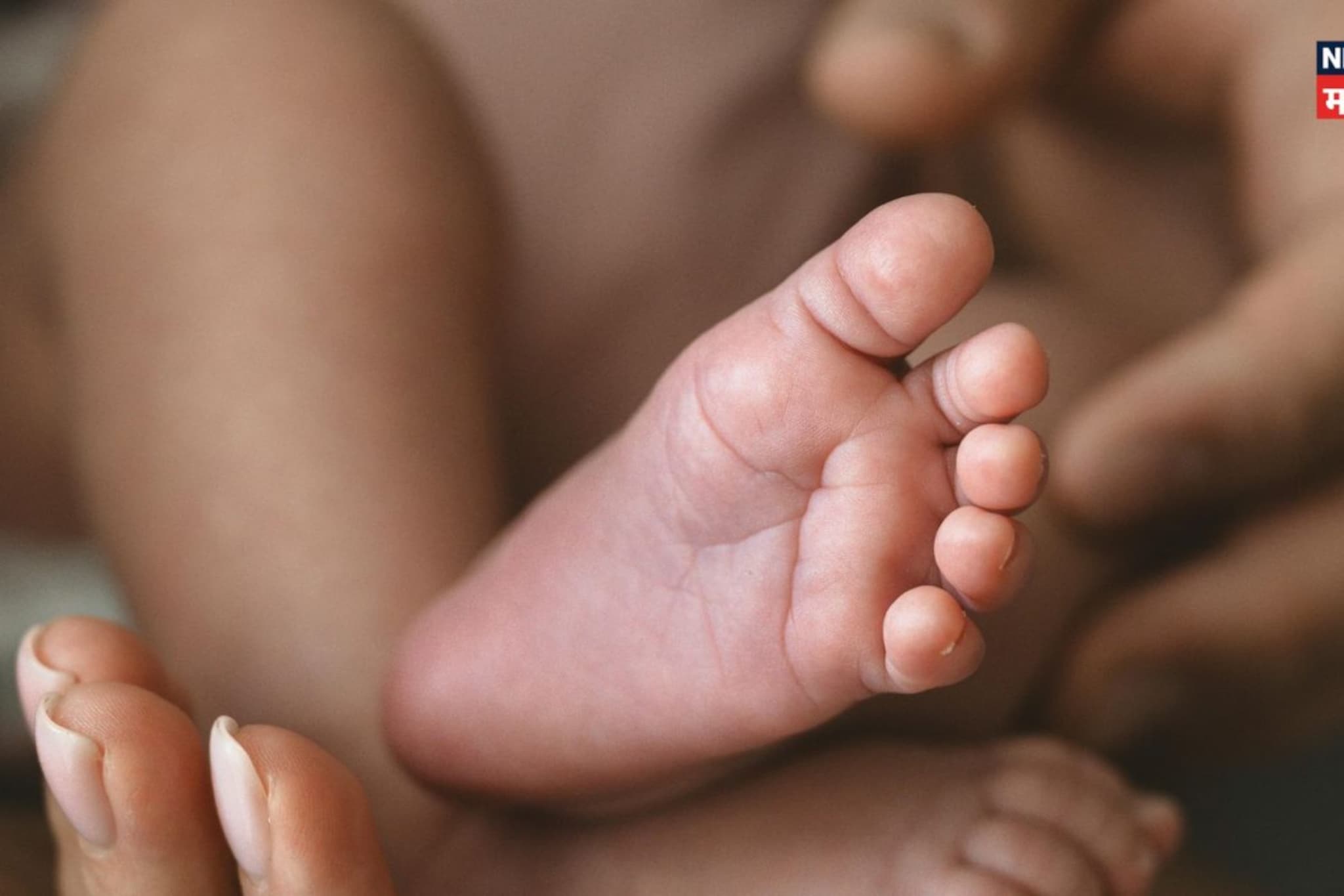 त्वचा नाही शरीरावर खोल भेगा, काय आहे हा दुर्मीळ आजार, जो महाराष्ट्रातल्या नवजात बाळात आढळला