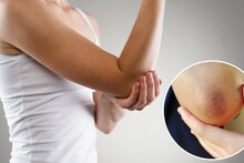 Home Remedy : हाताचे कोपर काळवंडलेत? 'हे' घरगुती उपाय करा, काही दिवसांत त्वचा होईल उजळ आणि मऊ