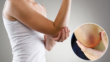 हाताचे कोपर काळवंडलेत? 'हे' घरगुती उपाय करा, काही दिवसांत त्वचा होईल उजळ आणि मऊ 