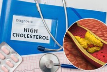 Ayurvedic Remedy : शरीरात कोलेस्टेरॉल वाढलंय! आजपासून खायला सुरु करा 'हे' पदार्थ, कमी होईल त्रास