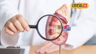 असह्य वेदना, तब्बल 3 तासांची शस्त्रक्रिया; पोटात पाव किलोचा...., ‘ते’ दृश्य पाहून सर्वांनाच धक्का