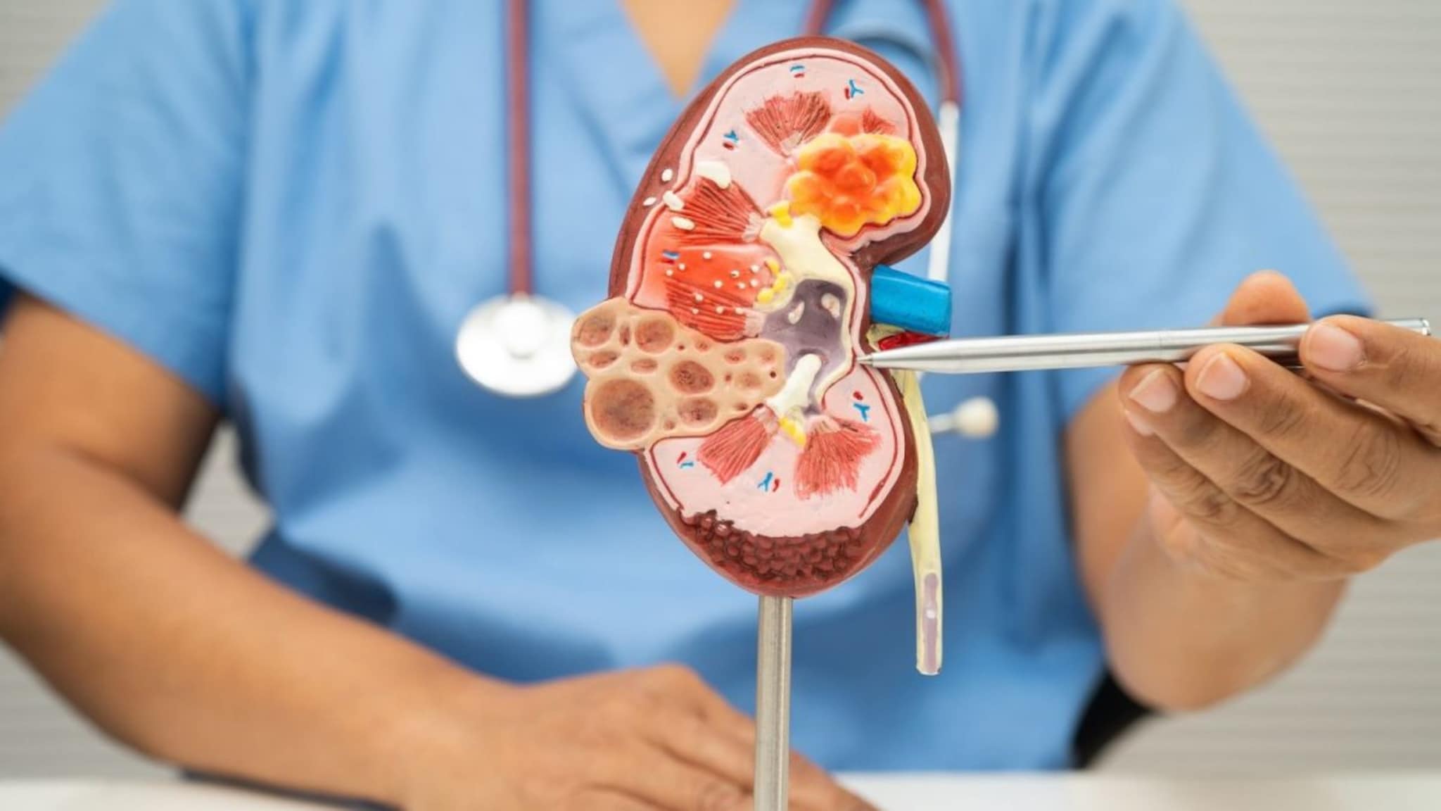 Kidney Cancer : किडनीच्या कॅन्सरपूर्वी शरीरात दिसतात ही लक्षणं, अजिबात करु नका Ignore, उशीर झाला तर पश्चातापाची येईल वेळ