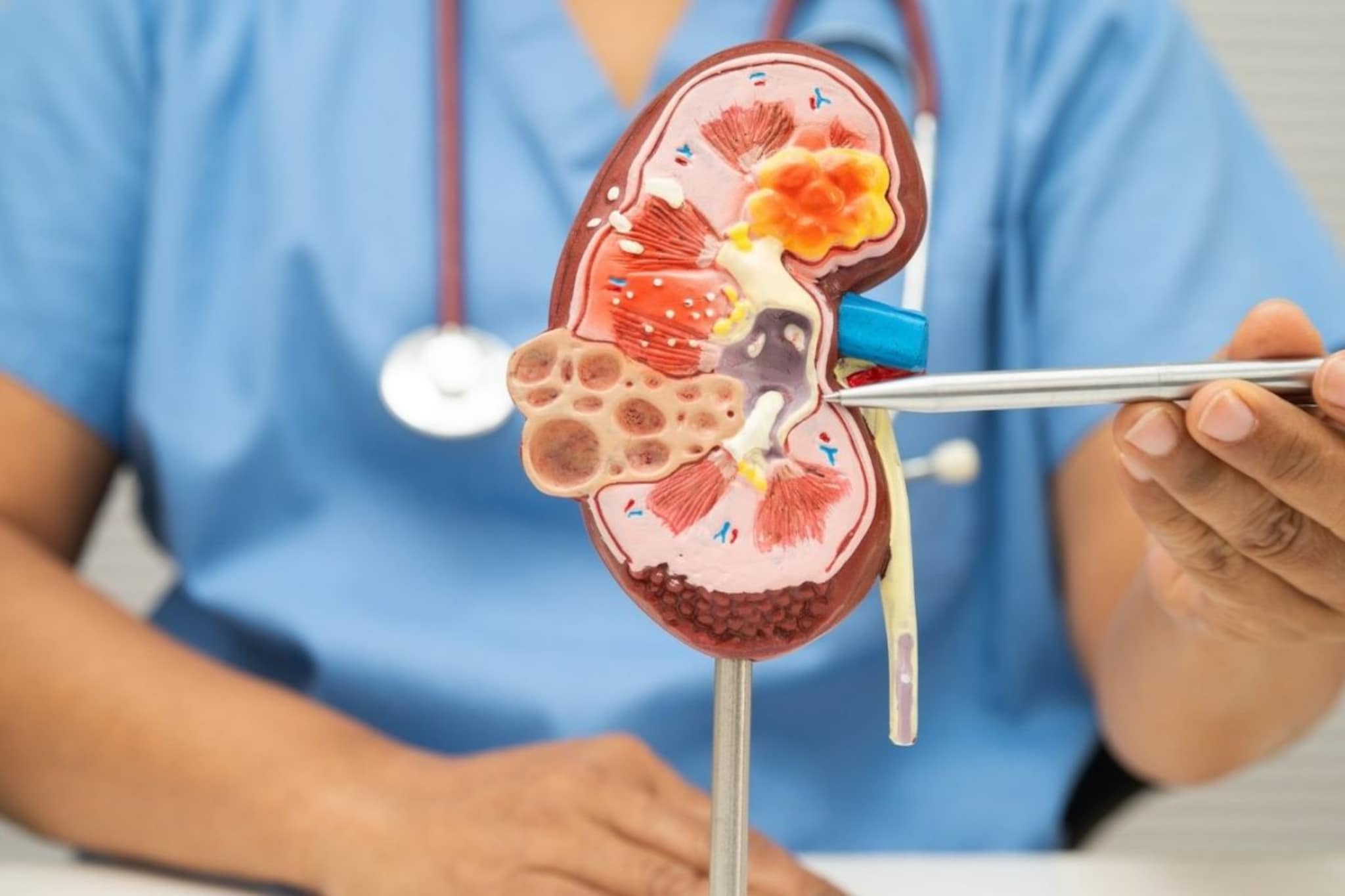 Kidney Cancer : किडनीच्या कॅन्सरपूर्वी शरीरात दिसतात ही लक्षणं, अजिबात करु नका Ignore, उशीर झाला तर पश्चातापाची येईल वेळ 