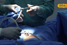 मोबाईल टॉर्चमध्ये शस्त्रक्रिया, ‘ती’ चूक अन् डॉक्टरांवर 12 वर्षांनी गुन्हा, काय घडलं?