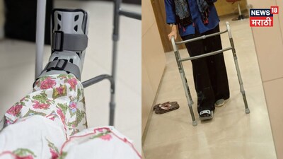 पैर में फ्रैक्चर, वॉकर का सहारा फिर भी जारी है काम: शिवानी रंगोले का प्रेरणादायक वापसी.