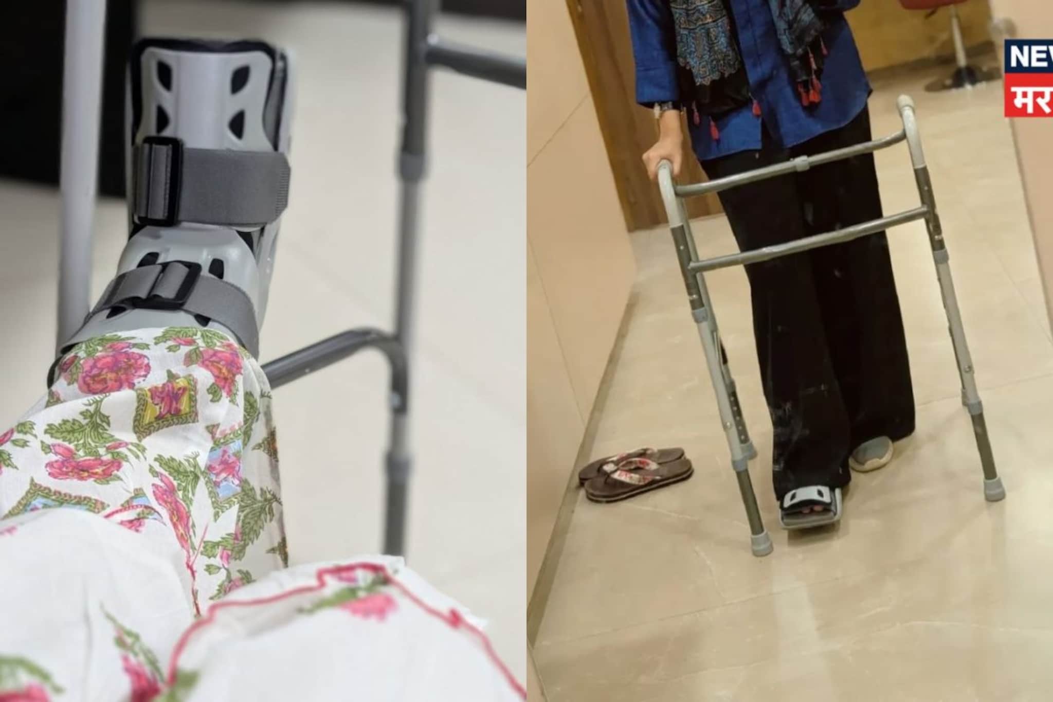 मराठी अभिनेत्रीच्या पायाला मोठी दुखापत, वॉकरचा आधार, पायाला फ्रॅक्चर; तरी करतेय काम , PHOTO