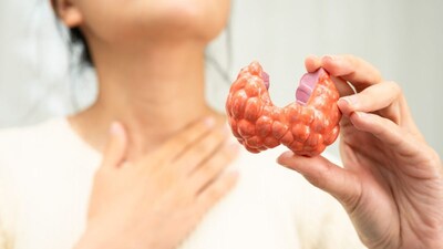 प्रतिकात्मक फोटो